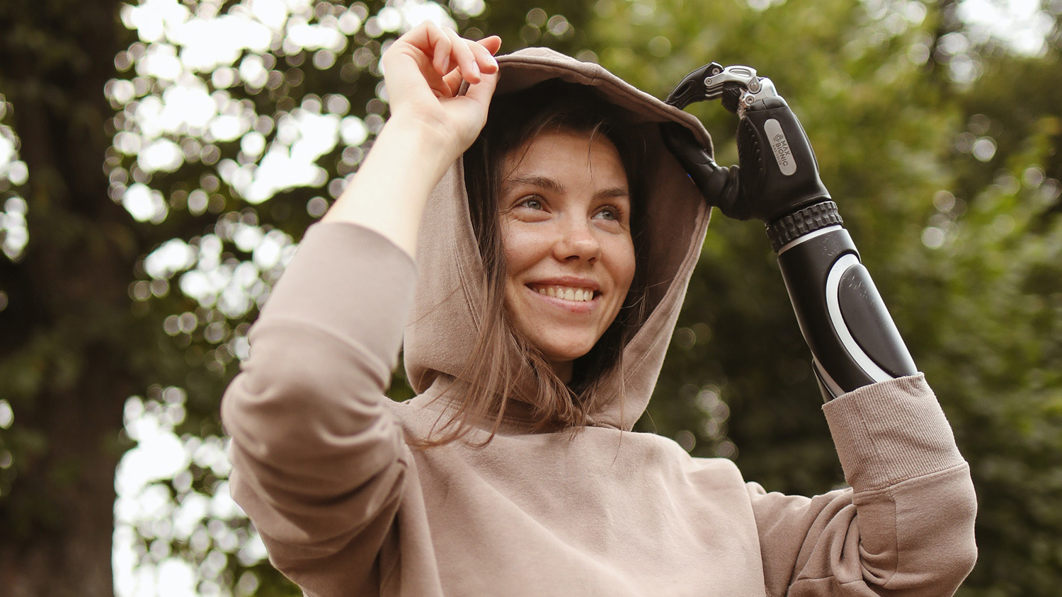 Femme avec une prothèse de bras - assurance accidents professionnels et invalidité Femme avec une prothèse de bras - assurance accidents professionnels et invalidité